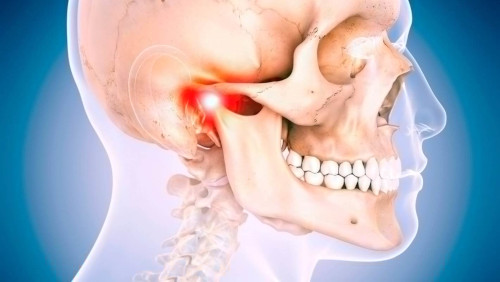 Complications of temporomandibular joint dysfunction