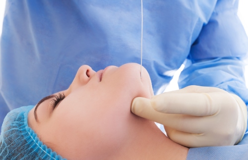 Chin liposuction