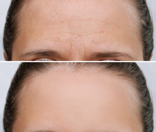 procedure result before/after